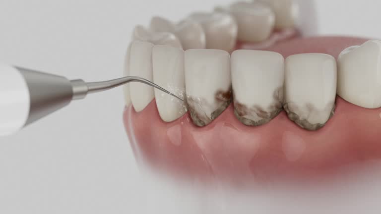Reliable Dental Implants contractor in Roy, UT by Smile Center Dentistry